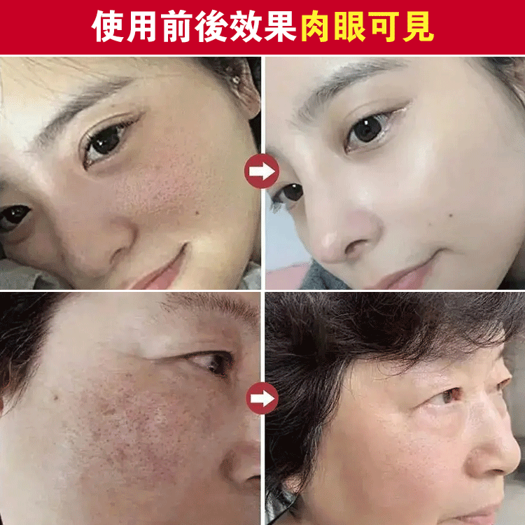 【毛孔縮縮】淨顏固體面膜    毛孔“吸麈器”，黑頭清道夫